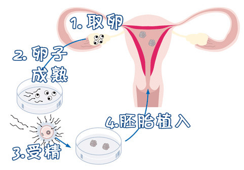 胚胎培养室